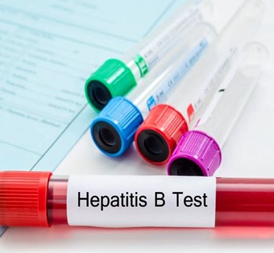 Prueba rápida para Hepatitis B